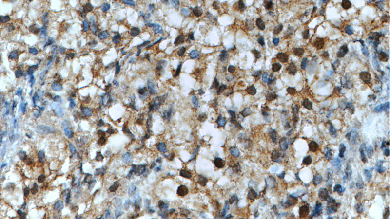 Immunohistochemistry of paraffin-embedded human ovary tissue slide using Catalog No:113267(NR2F1 Antibody) at dilution of 1:50 (under 40x lens)