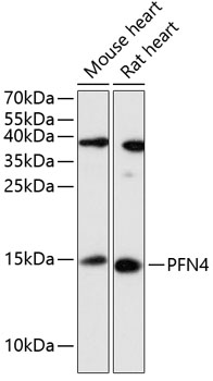 Western blot - PFN4 Polyclonal Antibody 