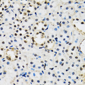 Immunohistochemistry - JADE1 Polyclonal Antibody 