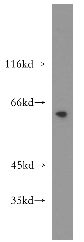 PC-3 cells were subjected to SDS PAGE followed by western blot with Catalog No:112457(MAK antibody) at dilution of 1:800
