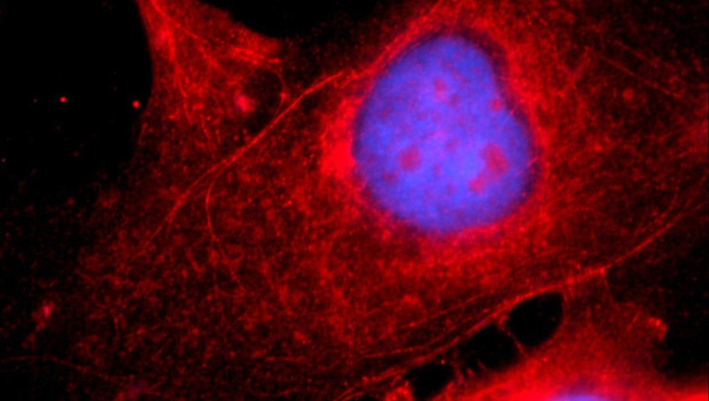 Immunofluorescent analysis of A431 cells using Catalog No:107869(CTNNA1 Antibody) at dilution of 1:25 and Rhodamine-Goat anti-Rabbit IgG