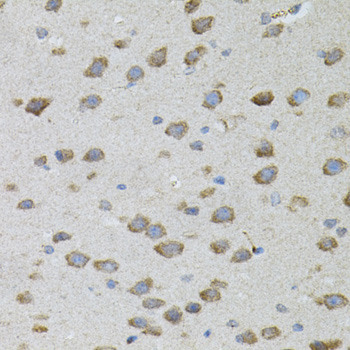 Immunohistochemistry - CDCA8 Polyclonal Antibody 