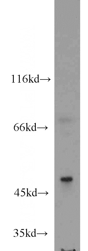 Jurkat cells were subjected to SDS PAGE followed by western blot with Catalog No:114538(RANBP3L antibody) at dilution of 1:1000