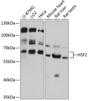 Western blot - HSF2 Polyclonal Antibody 
