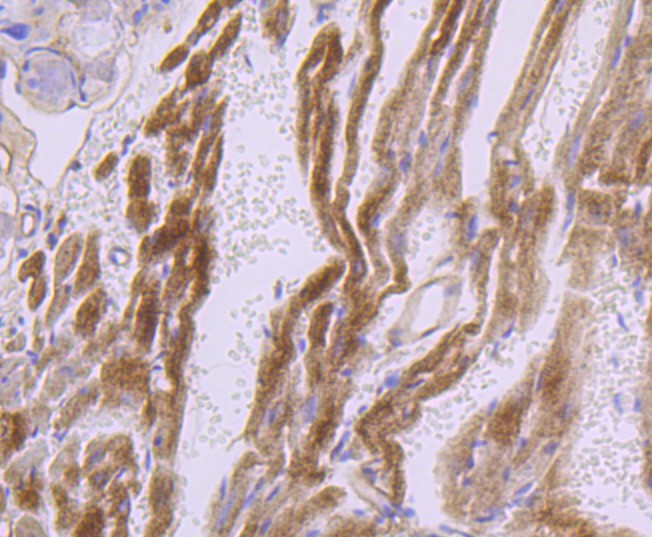 Fig6:; Immunohistochemical analysis of paraffin-embedded mouse heart tissue using anti-Dysferlin antibody. The section was pre-treated using heat mediated antigen retrieval with Tris-EDTA buffer (pH 8.0-8.4) for 20 minutes.The tissues were blocked in 5% BSA for 30 minutes at room temperature, washed with ddH; 2; O and PBS, and then probed with the primary antibody ( 1/50) for 30 minutes at room temperature. The detection was performed using an HRP conjugated compact polymer system. DAB was used as the chromogen. Tissues were counterstained with hematoxylin and mounted with DPX.