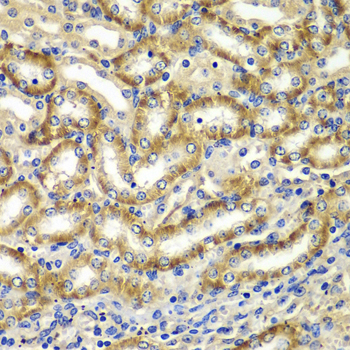Immunohistochemistry - DGKE Polyclonal Antibody 