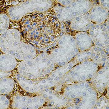 Immunohistochemistry - NTF3 Polyclonal Antibody 