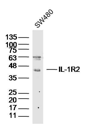 Fig3: Sample: SW480 Cell (Human) Lysate at 40 ug; Primary: Anti- IL-1R2 at 1/300 dilution; Secondary: IRDye800CW Goat Anti-Rabbit IgG at 1/20000 dilution; Predicted band size: 44 kD; Observed band size: 44 kD