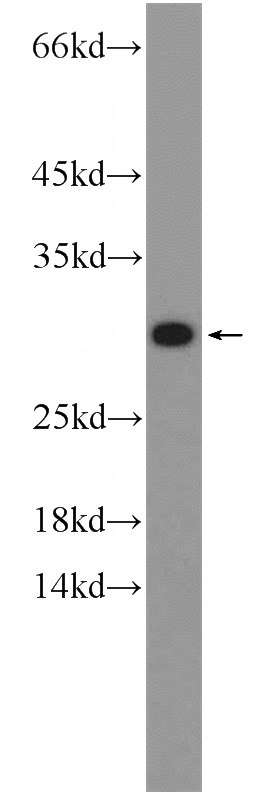 HepG2 cells were subjected to SDS PAGE followed by western blot with Catalog No:108699(C20orf20 Antibody) at dilution of 1:600