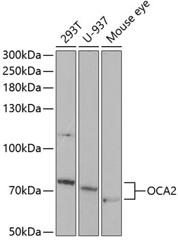 Western blot - OCA2 Polyclonal Antibody 