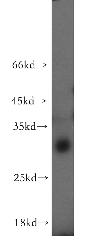 mouse lung tissue were subjected to SDS PAGE followed by western blot with Catalog No:108638(C11orf49 antibody) at dilution of 1:500