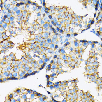 Immunohistochemistry - MCT1 Polyclonal Antibody 
