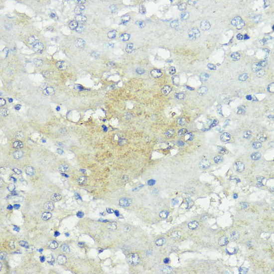 Immunohistochemistry - SOCS5 Polyclonal Antibody 