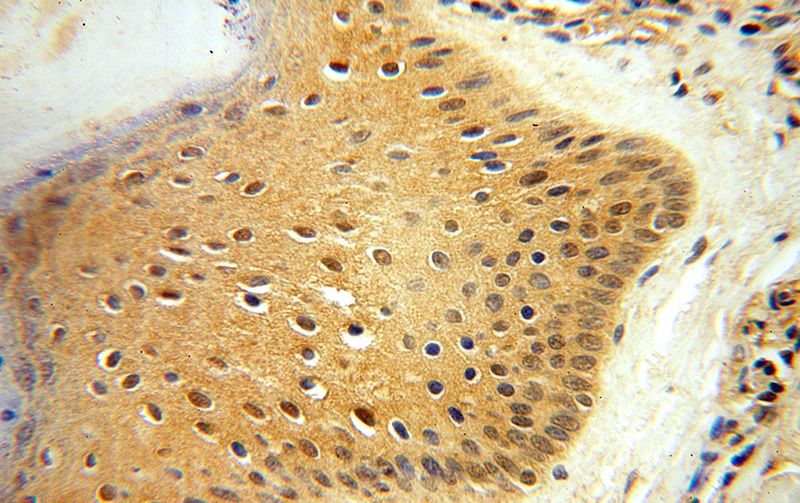 Immunohistochemical of paraffin-embedded human skin using Catalog No:113777(PGAM2 antibody) at dilution of 1:100 (under 40x lens)