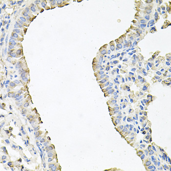 Immunohistochemistry - SCNN1G Polyclonal Antibody 