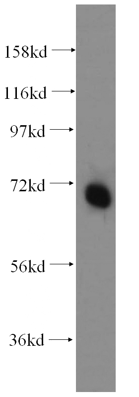 mouse testis tissue were subjected to SDS PAGE followed by western blot with Catalog No:113576(PAPOLB antibody) at dilution of 1:500