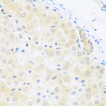 Immunohistochemistry - BRD9 Polyclonal Antibody 