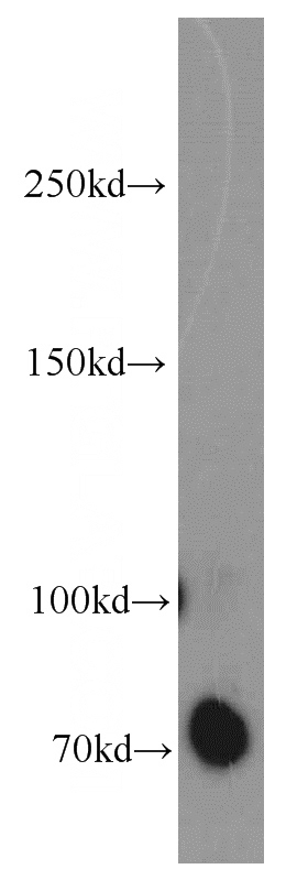 mouse brain tissue were subjected to SDS PAGE followed by western blot with Catalog No:110135(DYNC1I1 antibody) at dilution of 1:500