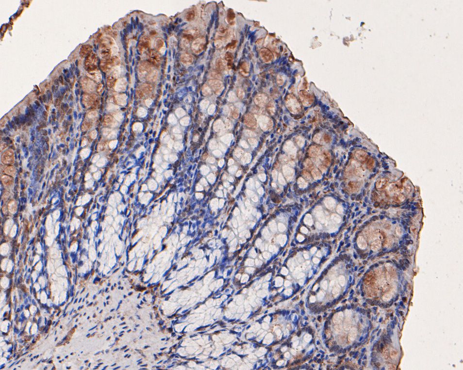 Fig2:; Immunohistochemical analysis of paraffin-embedded rat large intestine tissue using anti-FAM13C1 antibody. The section was pre-treated using heat mediated antigen retrieval with Tris-EDTA buffer (pH 8.0-8.4) for 20 minutes.The tissues were blocked in 5% BSA for 30 minutes at room temperature, washed with ddH; 2; O and PBS, and then probed with the primary antibody ( 1/100) for 30 minutes at room temperature. The detection was performed using an HRP conjugated compact polymer system. DAB was used as the chromogen. Tissues were counterstained with hematoxylin and mounted with DPX.