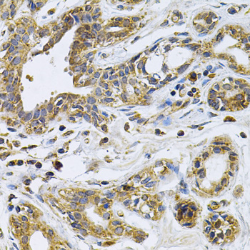 Immunohistochemistry - DRD3 Polyclonal Antibody 