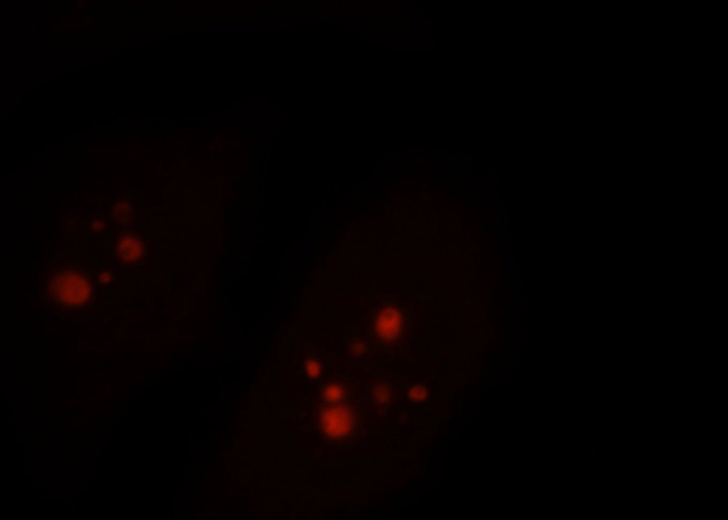 Immunofluorescent analysis of MCF-7 cells, using RBM19 antibody Catalog No:114604 at 1:25 dilution and Rhodamine-labeled goat anti-rabbit IgG (red).