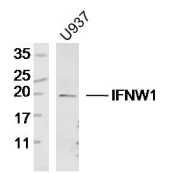 Fig2: Sample:; U937 Cell(Human)Lysate at 30 ug; Primary: Anti- IFNW1 at 1/300 dilution; Secondary: IRDye800CW Goat Anti-Rabbit IgG at 1/20000 dilution; Predicted band size: 20kD; Observed band size: 20kD