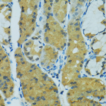 Immunohistochemistry - CYP2B6 Polyclonal Antibody 