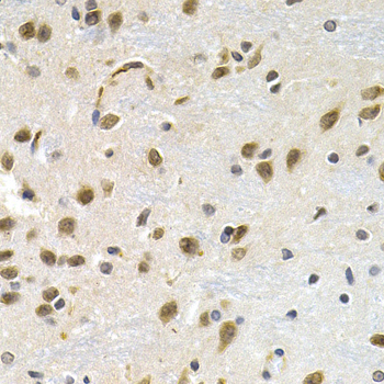 Immunohistochemistry - LBR Polyclonal Antibody 