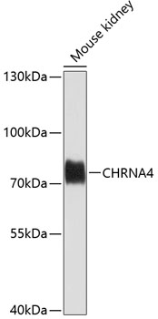 Western blot - CHRNA4 Polyclonal Antibody 