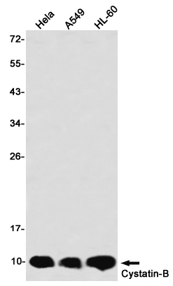 Western blot detection of Cystatin-B in Hela,A549,HL-60 using Cystatin-B Rabbit mAb(1:1000 diluted)