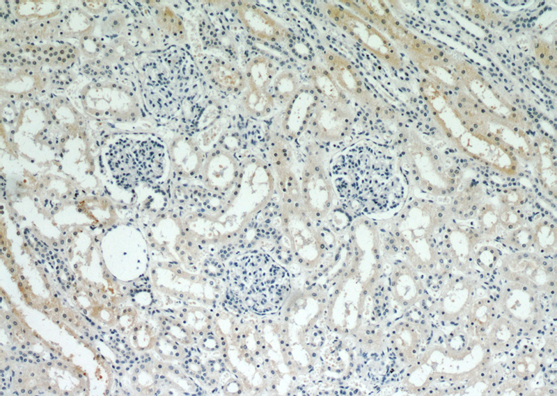 Immunohistochemical of paraffin-embedded human kidney using Catalog No:115442(SNAI2 antibody) at dilution of 1:200 (under 10x lens)