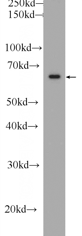 MCF-7 cells were subjected to SDS PAGE followed by western blot with Catalog No:110777(FRS2 Antibody) at dilution of 1:1000