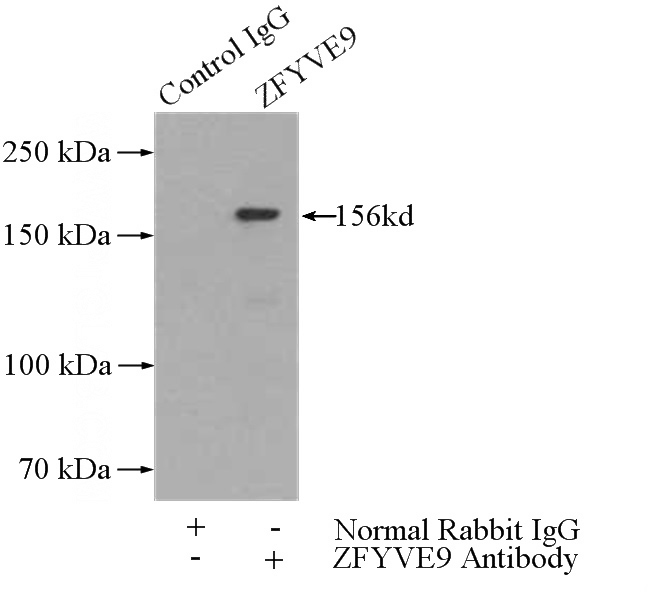 IP Result of anti-ZFYVE9 (IP:Catalog No:115068, 5ug; Detection:Catalog No:115068 1:500) with mouse brain tissue lysate 4000ug.