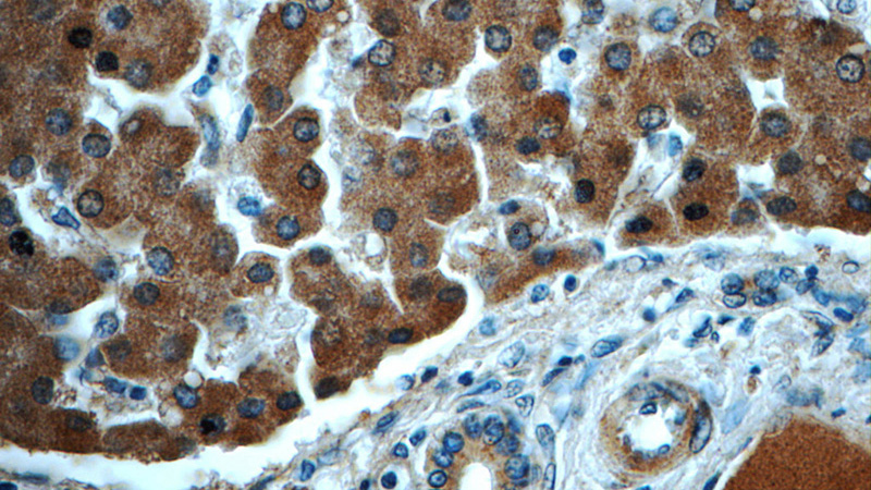 Immunohistochemistry of paraffin-embedded human liver tissue slide using Catalog No:117340(TF Antibody) at dilution of 1:50 (under 40x lens)