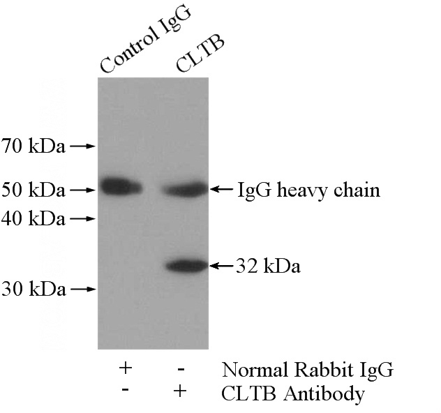 IP Result of anti-CLTB (IP:Catalog No:109406, 4ug; Detection:Catalog No:109406 1:500) with mouse brain tissue lysate 4000ug.