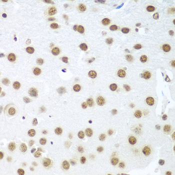 Immunohistochemistry - BCAS2 Polyclonal Antibody 