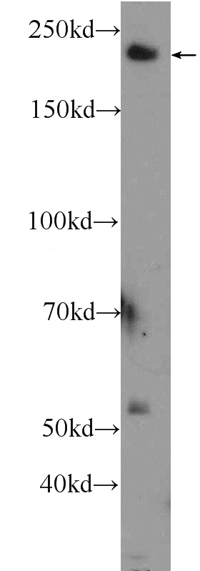 mouse brain tissue were subjected to SDS PAGE followed by western blot with Catalog No:114018(PLXNB1 Antibody) at dilution of 1:300