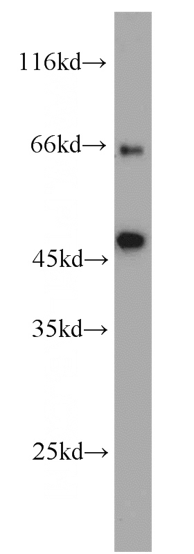 Jurkat cells were subjected to SDS PAGE followed by western blot with Catalog No:114629(TRIM13 antibody) at dilution of 1:1000