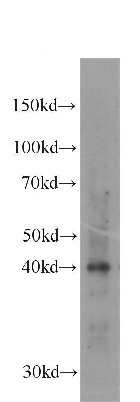 HeLa cells were subjected to SDS PAGE followed by western blot with Catalog No:107073(AURKB antibody) at dilution of 1:500