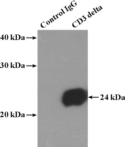 IP Result of anti-CD3D (IP:Catalog No:109019, 4ug; Detection:Catalog No:109019 1:800) with Jurkat cells lysate 2800ug.