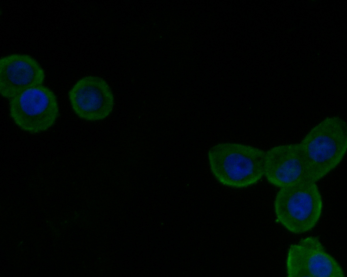 Fig2:; ICC staining of VLDL Receptor in LOVO cells (green). Formalin fixed cells were permeabilized with 0.1% Triton X-100 in TBS for 10 minutes at room temperature and blocked with 1% Blocker BSA for 15 minutes at room temperature. Cells were probed with the primary antibody ( 1/100) for 1 hour at room temperature, washed with PBS. Alexa Fluor®488 Goat anti-Rabbit IgG was used as the secondary antibody at 1/1,000 dilution. The nuclear counter stain is DAPI (blue).