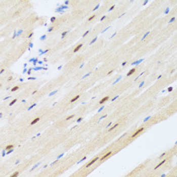 Immunohistochemistry - MTA3 Polyclonal Antibody 