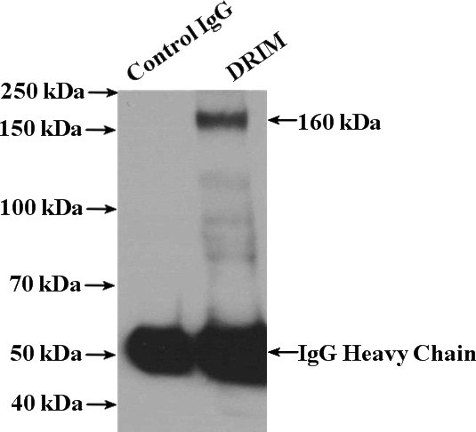 IP Result of anti-UTP20 (IP:Catalog No:110022, 4ug; Detection:Catalog No:110022 1:800) with HeLa cells lysate 4000ug.