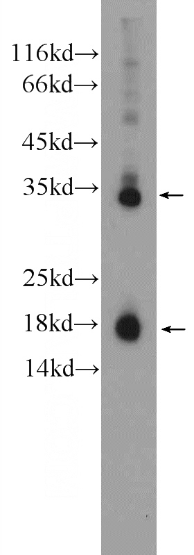 Jurkat cells were subjected to SDS PAGE followed by western blot with Catalog No:108876(Caspase 3 Antibody) at dilution of 1:600