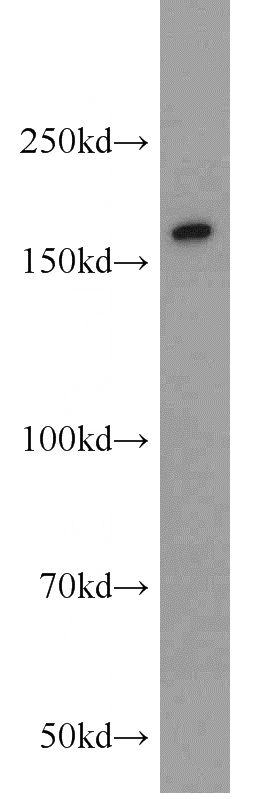 Y79 cells were subjected to SDS PAGE followed by western blot with Catalog No:115786(SYNM antibody) at dilution of 1:1000