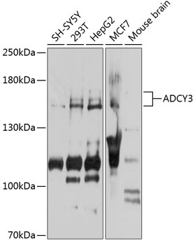 Western blot - ADCY3 Polyclonal Antibody 