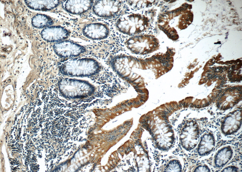 Immunohistochemistry of paraffin-embedded human colon tissue slide using Catalog No:109805(KRT20 Antibody) at dilution of 1:50 (under 10x lens)