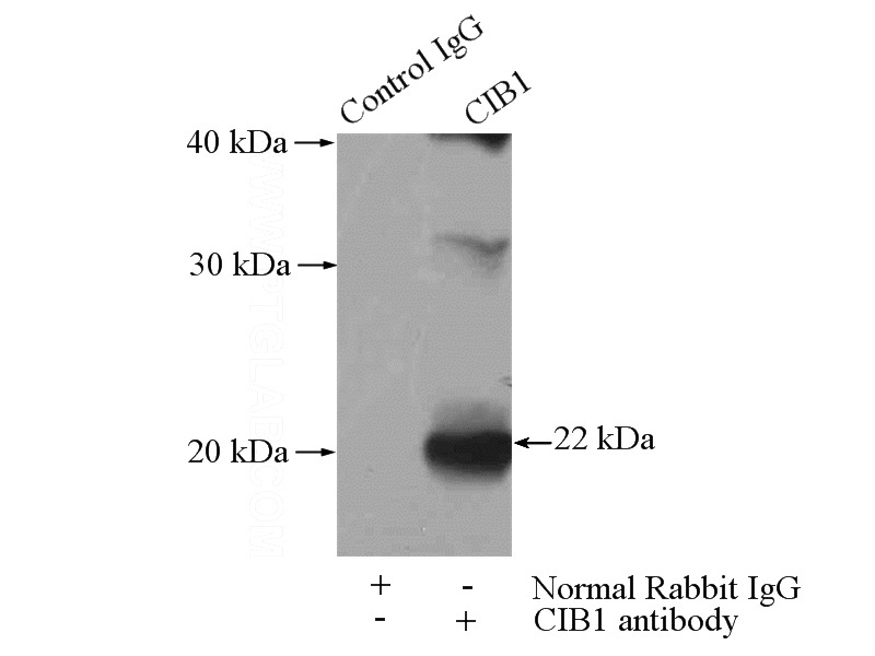 IP Result of anti-CIB1 (IP:Catalog No:109311, 4ug; Detection:Catalog No:109311 1:300) with mouse testis tissue lysate 4000ug.