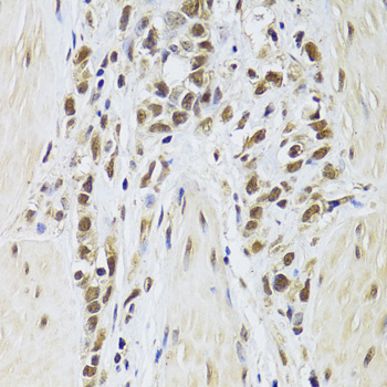 Immunohistochemistry - SF1 Polyclonal Antibody 