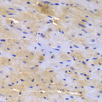 Immunohistochemistry - SGCE Polyclonal Antibody 